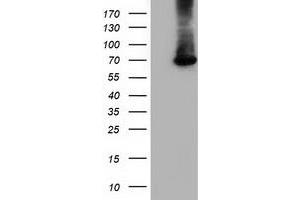 HEK293T cells were transfected with the pCMV6-ENTRY control (Left lane) or pCMV6-ENTRY EPM2AIP1 (Right lane) cDNA for 48 hrs and lysed. (EPM2AIP1 antibody)