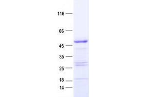 YBX2 Protein (His tag)