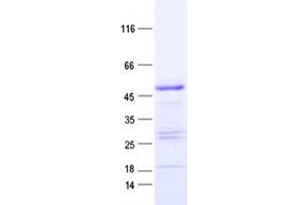 YBX2 Protein (His tag)
