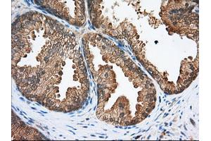 Immunohistochemical staining of paraffin-embedded Human Kidney tissue using anti-SNX9 mouse monoclonal antibody. (SNX9 antibody)