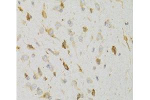 Immunohistochemistry of paraffin-embedded Rat brain using KISS1R Polyclonal Antibody at dilution of 1:100 (40x lens). (KISS1R antibody)