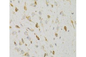 Immunohistochemistry of paraffin-embedded Rat brain using KISS1R Polyclonal Antibody at dilution of 1:100 (40x lens).