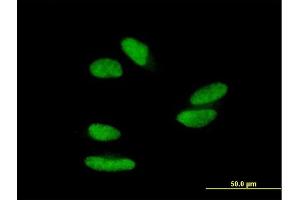 Immunofluorescence of purified MaxPab antibody to ZNF398 on HepG2 cell. (ZNF398 antibody  (AA 1-642))