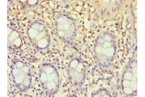 Immunohistochemistry of paraffin-embedded human colon tissue using ABIN7151765 at dilution of 1:100 (ECE2 antibody  (AA 1-160))