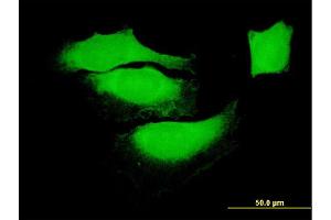 Immunofluorescence of monoclonal antibody to BAG1 on HeLa cell. (BAG1 antibody  (AA 241-345))