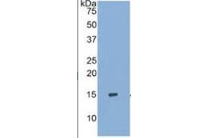 WB of Protein Standard: different control antibodies  against Highly purified E. (S100A9 ELISA Kit)