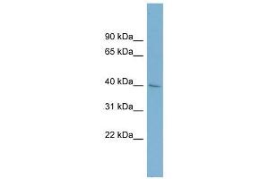 A4GALT antibody used at 1 ug/ml to detect target protein.