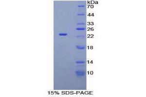 SDS-PAGE (SDS) image for Fibrillin 1 (FBN1) (AA 959-1145) protein (His tag) (ABIN2121031) (Fibrillin 1 Protein (FBN1) (AA 959-1145) (His tag))