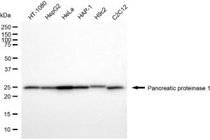 Western blotting analysis using pancreatic proteinase 1 antibody (ABIN7799732). (Recombinant Pancreatic Proteinase 1 (PRT1) antibody)