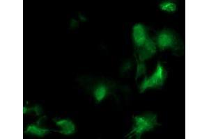 Image no. 3 for anti-Meis Homeobox 3 (MEIS3) (AA 1-261) antibody (ABIN1490669)