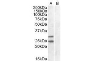 Image no. 2 for anti-Suppressor of Cytokine Signaling 1 (SOCS1) (C-Term) antibody (ABIN374072) (SOCS1 antibody  (C-Term))
