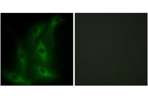 Immunofluorescence analysis of HeLa cells, using Collagen IV alpha6 Antibody. (COL4a6 antibody  (AA 1201-1250))