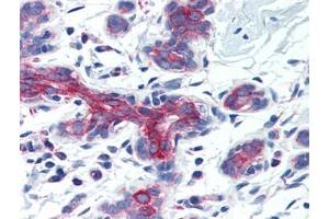 Human Breast (formalin-fixed, paraffin-embedded) stained with AIFM3at 5 µg/ml followed by biotinylated goat anti-rabbit IgG secondary antibody, alkaline phosphatase-streptavidin and chromogen. (AIFM3 antibody  (Center))