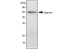 Western blot analysis of mouse liver extract was resolved by SDS - PAGE , transferred to PVDF membrane and probed with ADIPOQ monoclonal antibody , clone 5H7 (1 : 2000)  . (ADIPOQ antibody  (AA 15-244))