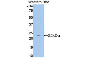 Western Blotting (WB) image for anti-Bleomycin Hydrolase (BLMH) (AA 30-165) antibody (ABIN3201698)