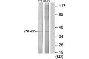 Western Blotting (WB) image for anti-Zinc Finger and SCAN Domain Containing 16 (ZSCAN16) (AA 191-240) antibody (ABIN2889761)