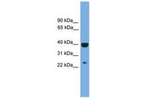 Image no. 1 for anti-Suppressor of Cytokine Signaling 1 (SOCS1) (AA 107-156) antibody (ABIN6744715) (SOCS1 antibody  (AA 107-156))