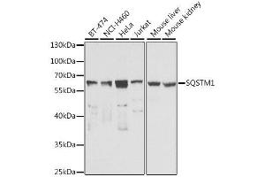 Western blot analysis of extracts of various cell lines, using SQSTM1 antibody. (SQSTM1 antibody  (AA 1-440))