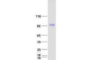 Validation with Western Blot (SCARB1 Protein (Transcript Variant 2) (Myc-DYKDDDDK Tag))