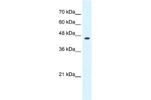 WB Suggested Anti-GLIS3 Antibody Titration:  0. (GLIS3 antibody  (C-Term))