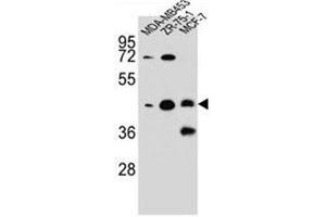 Western blot analysis of hCG_1645727 Antibody (C-term) in MDA-MB453,ZR-75-1,MCF-7 cell line lysates (35ug/lane). (KBTBD13 antibody  (C-Term))