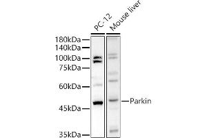 Western Blotting (WB) image for anti-Parkinson Protein 2, E3 Ubiquitin Protein Ligase (Parkin) (PARK2) (AA 1-300) antibody (ABIN3021179)