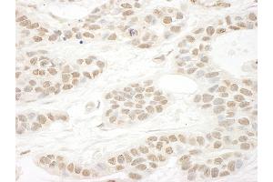 Immunohistochemistry (IHC) image for anti-serine/arginine-Rich Splicing Factor 10 (SRSF10) (AA 133-183) antibody (ABIN7448969)