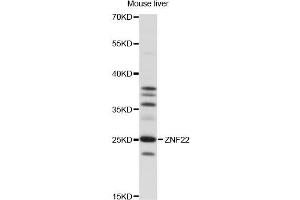 Western blot analysis of extracts of mouse liver, using ZNF22 antibody (ABIN6291375) at 1:1000 dilution.