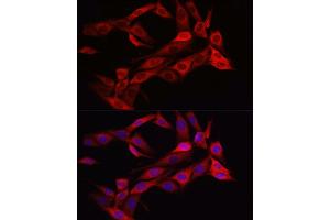 Immunofluorescence (IF) image for anti-Asparagine Synthetase (ASNS) (AA 262-561) antibody (ABIN6137209)