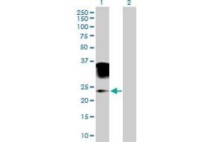 Western Blot analysis of ORM2 expression in transfected 293T cell line by ORM2 MaxPab polyclonal antibody. (Orosomucoid 2 antibody  (AA 1-201))