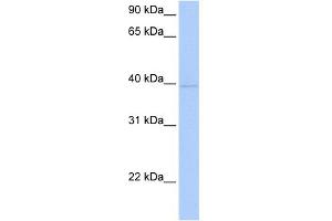 WB Suggested Anti-ZNF385D Antibody Titration:  0. (ZNF385D antibody  (C-Term))
