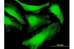 Immunofluorescence of purified MaxPab antibody to SDCBP on HeLa cell.