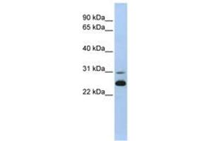 Image no. 1 for anti-Adenylate Kinase 1 (AK1) (AA 36-85) antibody (ABIN6741020) (Adenylate Kinase 1 antibody  (AA 36-85))