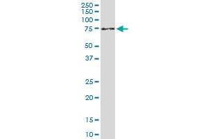 ENTH monoclonal antibody (M03), clone 1E6. (CLINT1 antibody  (AA 161-261))
