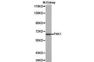 Western Blotting (WB) image for anti-P21-Activated Kinase 1 (PAK1) antibody (ABIN1874025) (PAK1 antibody)