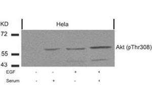 Image no. 2 for anti-V-Akt Murine Thymoma Viral Oncogene Homolog 1 (AKT1) (pThr308) antibody (ABIN196711) (AKT1 antibody  (pThr308))