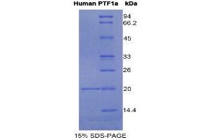 SDS-PAGE (SDS) image for Pancreas Specific Transcription Factor, 1a (PTF1A) (AA 177-328) protein (His tag) (ABIN1080444)