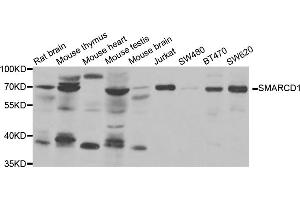 Western blot analysis of extracts of various cell lines, using SMARCD1 antibody (ABIN5973730) at 1/1000 dilution. (SMARCD1 antibody)