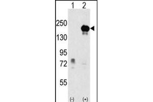 Western blot analysis of EHMT1 (arrow) using rabbit polyclonal EHMT1 Antibody (Center) (ABIN387856 and ABIN2844018). (EHMT1 antibody  (AA 367-396))
