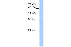 NSUN5C antibody used at 2. (NSUN5P2 antibody  (Middle Region))