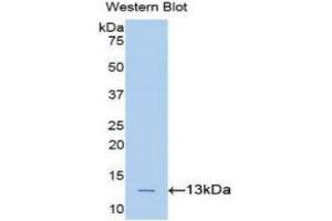 Western Blotting (WB) image for anti-Phospholipase A2-Activating Protein (PLAA) (AA 367-468) antibody (ABIN1860253)
