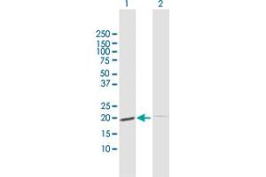 Western Blot analysis of ESM1 expression in transfected 293T cell line by ESM1 MaxPab polyclonal antibody. (ESM1 antibody  (AA 1-184))