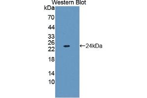 Detection of Recombinant FTL, Human using Polyclonal Antibody to Ferritin, Light Polypeptide (FTL) (FTL antibody  (AA 2-175))
