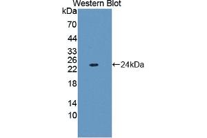 Detection of Recombinant FTL, Human using Polyclonal Antibody to Ferritin, Light Polypeptide (FTL)