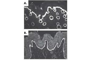 Image no. 2 for anti-Collagen, Type VII (COL7) (AA 479-578), (AA 757-967), (AA 97-200) antibody (ABIN191494) (COL7 antibody  (AA 97-200, AA 479-578, AA 757-967))