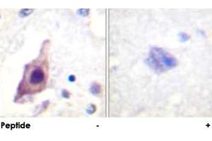 Immunohistochemical analysis of paraffin-embedded human brain tissue using CDC25B polyclonal antibody . (CDC25B antibody)