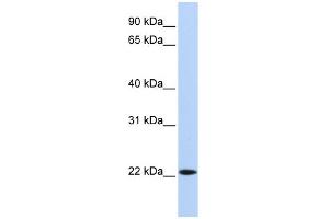 WB Suggested Anti-SSX5 Antibody Titration:  0.