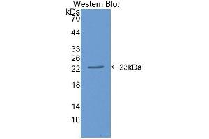 Detection of Recombinant CD27BP, Human using Polyclonal Antibody to CD27 Binding Protein (CD27BP) (SIVA1 antibody  (AA 1-175))