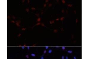 Immunofluorescence (IF) image for anti-Small Ubiquitin Related Modifier Protein 1 (SUMO1) antibody (ABIN7260199)