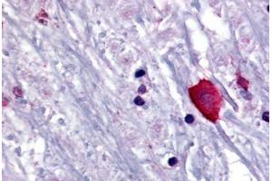 Human Brain, Thalamus (formalin-fixed, paraffin-embedded) stained with BRS3 antibody ABIN213381 at 10 ug/ml followed by biotinylated goat anti-rabbit IgG secondary antibody ABIN481713, alkaline phosphatase-streptavidin and chromogen. (BRS3 antibody  (N-Term))